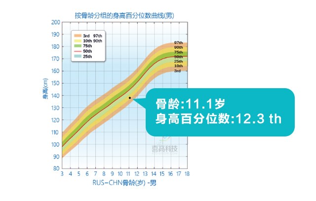 判斷孩子的高矮？這3點(diǎn)沒搞清楚會(huì)后悔！_05.jpg