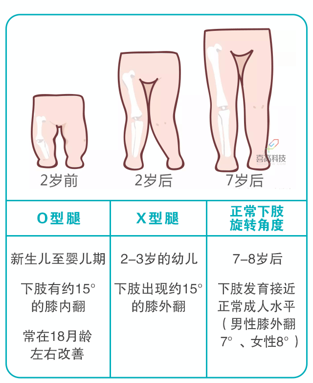 寶寶身長(zhǎng)腿短，長(zhǎng)大會(huì)是矮個(gè)子嗎？_03.gif