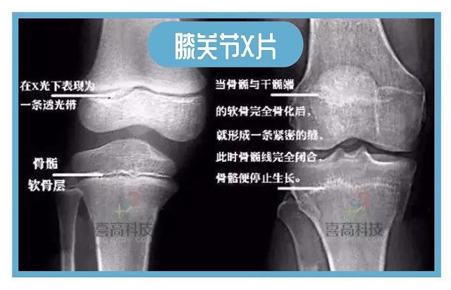 默認標題_自定義cm_2019-11-22-0.jpg